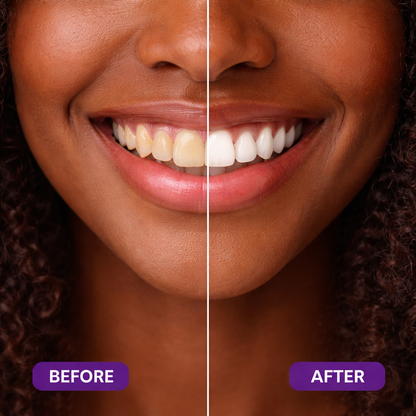 Tiras blanqueadoras moradas